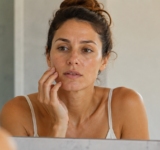 Mujer mirando su rostro con acne después del verano